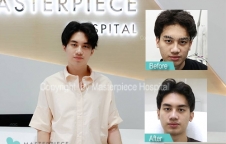 โชว์ผิวหน้าใส ด้วย Acne Pack กับเสือ - เสฎกานต์ (ลูกชายเสก โลโซ)