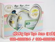 ฮารุ ByeByeAcne ลดสิวอักเสบชนิดรุนแรงและปานกลาง ลดรอยกำจากสิว ลดสิวอุดตัน