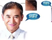 พรสวรรค์ HAIR CENTER แก้ปัญหาผมบาง ด้วยการทอผม เพิ่มผมหนา