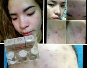 ครีมหน้าขาว หน้าเงา หน้าเด็ก by Princess White Skincare