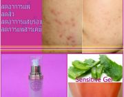 แบรนด์ Nori Sensitive Gel