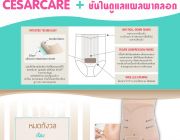 CesarCare ชั้นในดูแลแผลผ่าคลอด