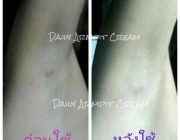 ครีมรักแร้ขาว Daily Armpit Cream