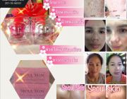 ครีมนำเข้าจากเกาหลี Seoul Skin Cosmeceuticals Cream