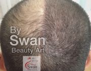 พี่เอ้ Swan Beauty Art รับสอนสักไรผมสามมิติ บริการสักไรผมสามมิติ แก้ไขปัญหา ศีรษะล้าน ผมบาง แสกกว้าง หน้าผากกว้าง หัวเถิก และปกปิด รอยแผลเป็นบนศีรษะ