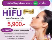 ultra hifu เก็บเหนียง ลดคาง2ชั้น ไม่เจ็บเหมือนร้อยไหม โปรโมชั่นสุดๆ 5900บาทจร้า